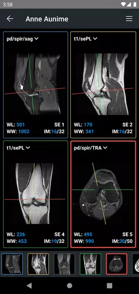 Schermata IDV - IMAIOS DICOM Viewer 2