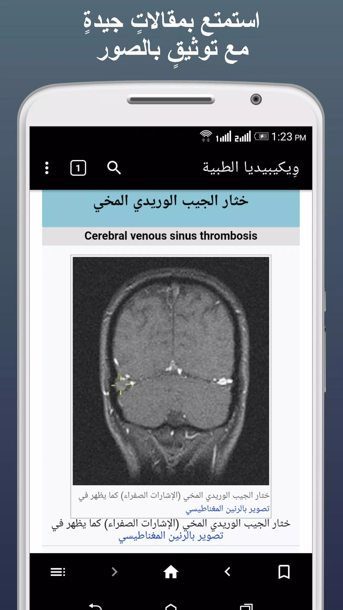 ويكيبيديا الطبية Captura de pantalla 2