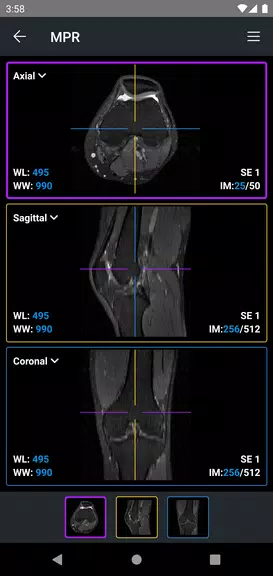 IDV - IMAIOS DICOM Viewer ဖန်သားပြင်ဓာတ်ပုံ 3